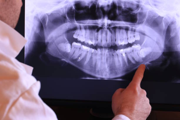 Best Walk-In Emergency Dentist in South Run, VA