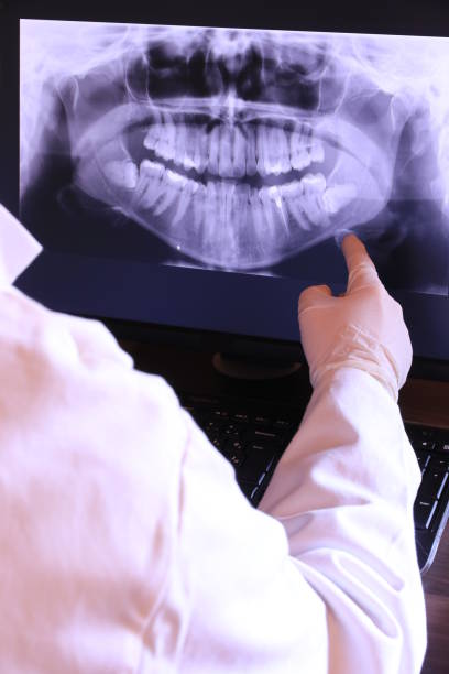 Best Emergency Tooth Extraction in South Run, VA
